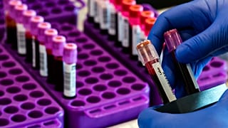 Wien: Schnelltest am Flughafen löst Quarantäne ab
