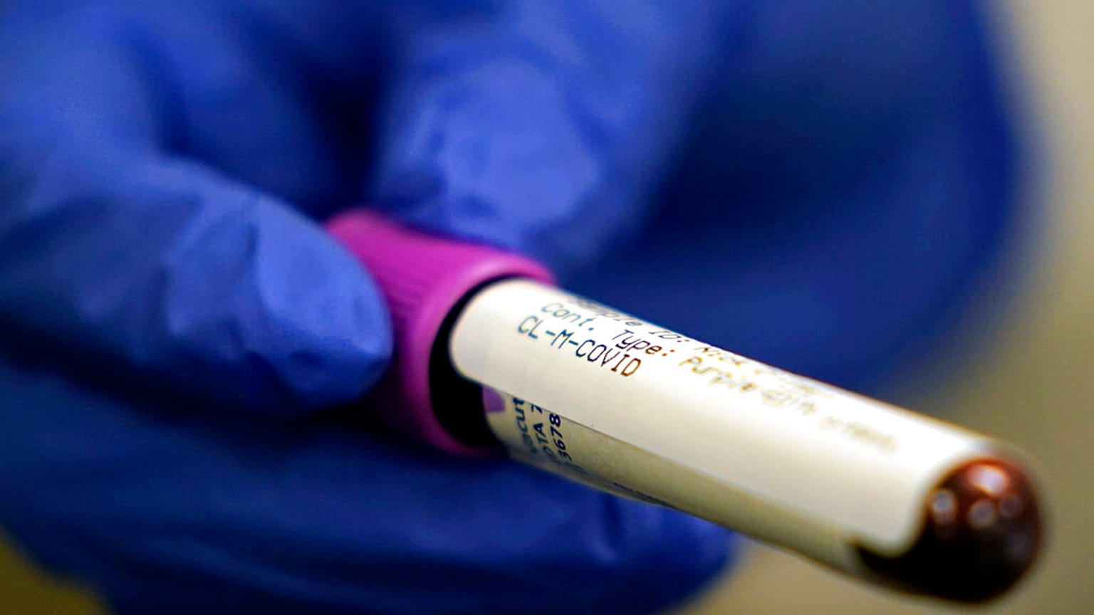 COVID-19 Antibody test