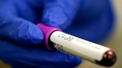 COVID-19 Antibody test