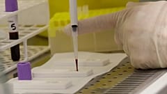 Çin'deki araştırmada menide SARS-CoV-2 tespit edildi