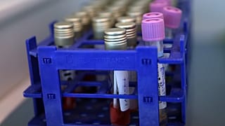 Διεθνές βραβείο σε ελληνικά ΑΕΙ για πλατφόρμα άμεσου εντοπισμού κρουσμάτων κορονοϊού