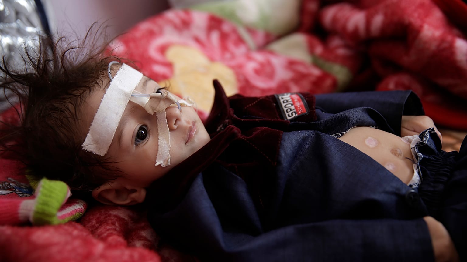 Virus Outbreak Mideast Children