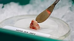 Egészséges agy élősejtes szövetmintája egy seattle-i laboratóriumban