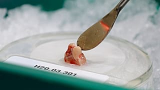 Egészséges agy élősejtes szövetmintája egy seattle-i laboratóriumban