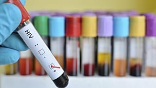 Uzmanlar uyarıyor: Covid-19'a karşı alınan önlemler AIDS hastalarının artışına neden olabilir