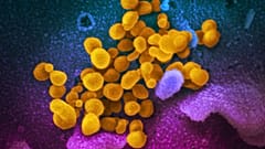 Virus Outbreak Inflammatory Condition Kids