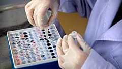 Επιστήμονες εντόπισαν αντίσωμα που μπλοκάρει τη λοίμωξη από τον νέο κορονοϊό