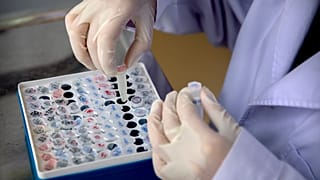 Archive Photo/ Virus Outbreak