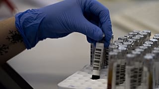 Campioni di sangue da sottoporre a test sierologici al Policlinico Tor Vergata di Roma