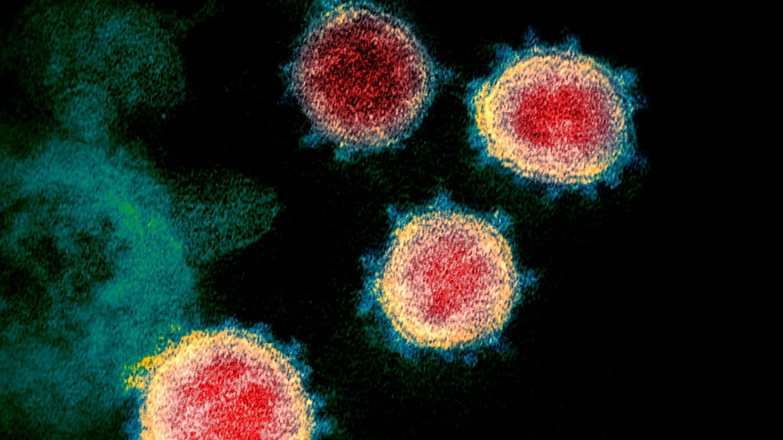 SARS-CoV-2, the coronavirus that causes COVID-19, in an electron microscope image made available by the U.S. National Institutes of Health in February 2020 