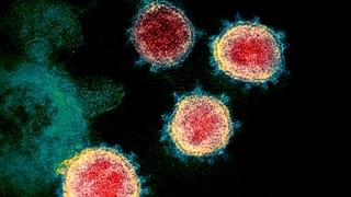 SARS-CoV-2, the coronavirus that causes COVID-19, in an electron microscope image made available by the U.S. National Institutes of Health in February 2020 