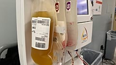 صورة لبلازما الدم لمتبرعين 