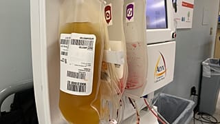 صورة لبلازما الدم لمتبرعين 