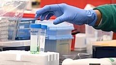 ΠΟΥ: Νέα δεδομένα για την πρόληψη της μετάδοσης του SARS-CoV-2