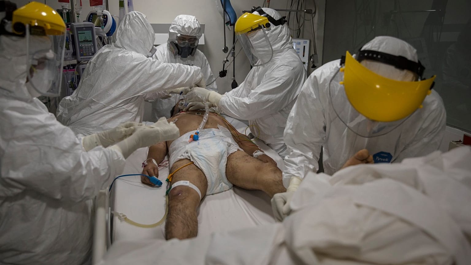 Médicos y enfermeras atienden a un paciente dentro de la unidad de cuidados intensivos para casos de COVID-19 en el hospital privado Ricardo Palma, en Lima, Perú.