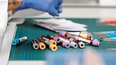Κύπρος: Μόνο 1 νέο κρούσμα COVID-19