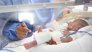 La hazaña de Jorge, el bebé peruano de 550 gramos que venció a la COVID-19