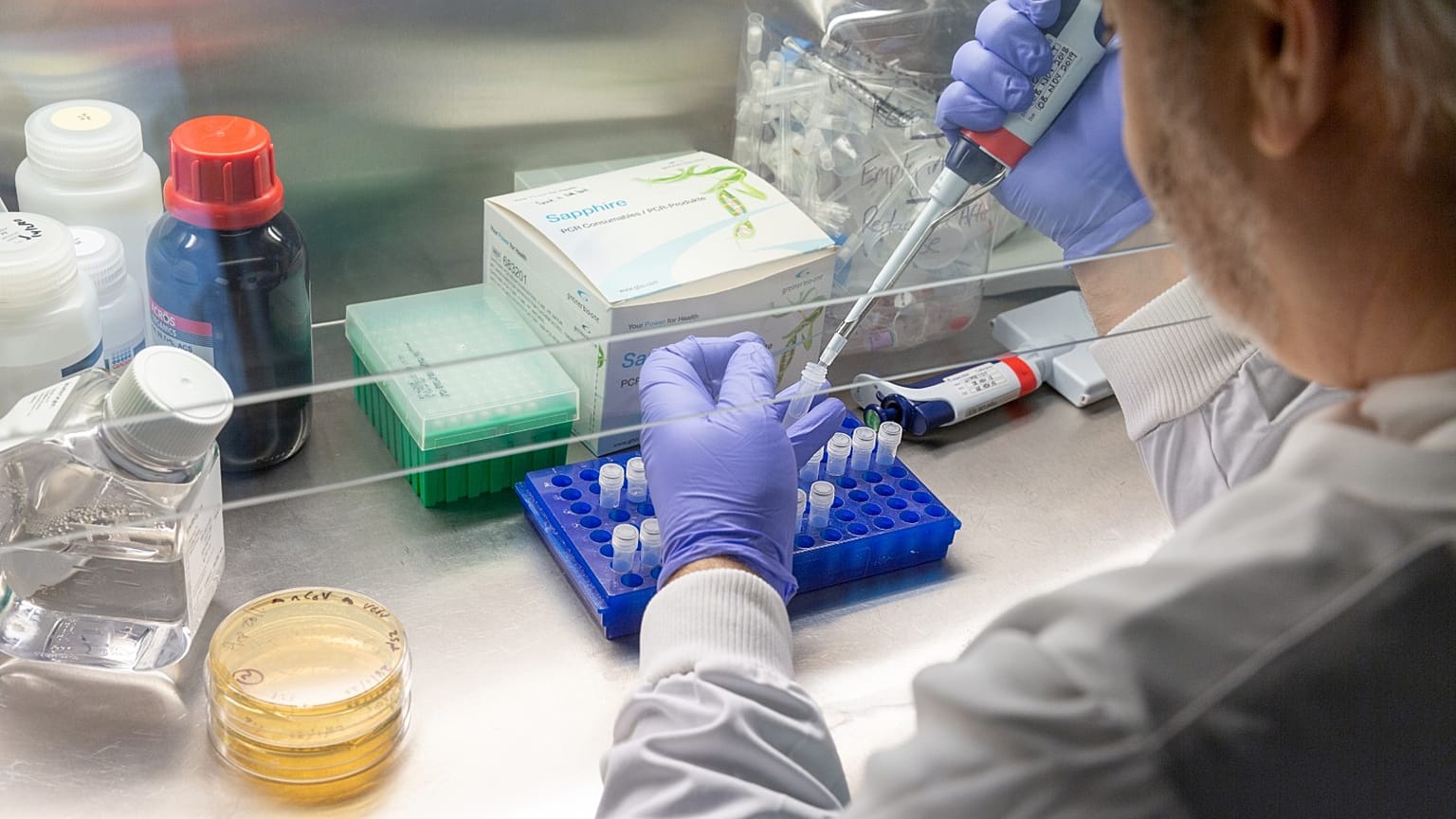 El Dr. Paul McKay trabajando en el laboratorio de Shattock.
