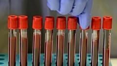 Кровь доноров в лаборатории Имперского колледжа Лондона, где разрабатывают вакцину от коронавируса.