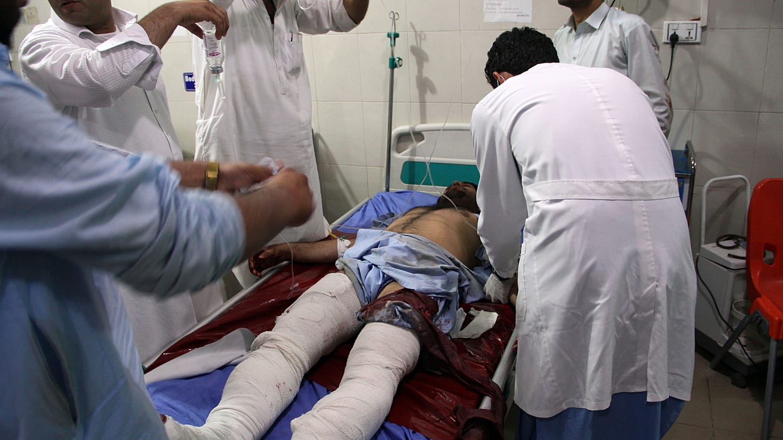 A wounded man receives treatment at a hospital after a suicide car bomb and multiple gunmen attack in the city of Jalalabad, east of Kabul, Afghanistan, Sunday, Aug. 2, 2020.