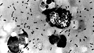 Yersinia pestis isimli bakteri