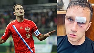 Roman Sirokov (balra) és a megvert bíró