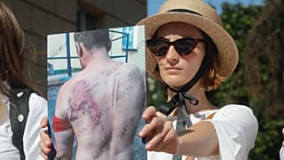 Belarus'un başkenti Minsk'te bir kadın protestolar sırasında polis şiddetine uğradığını iddia ettiği arkadaşının fotoğrafını gösteriyor