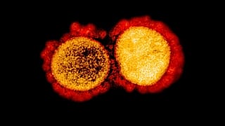AFP PHOTO /NATIONAL INSTITUTE OF ALLERGY AND INFECTIOUS DISEASES/HANDOUT