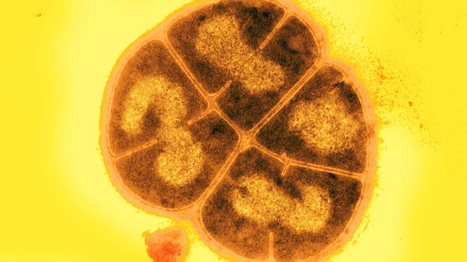 Deinococcus