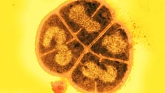Deinococcus