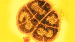 Deinococcus