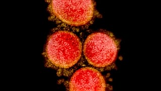 SARS-CoV-2 virus particles, isolated from a patient. 