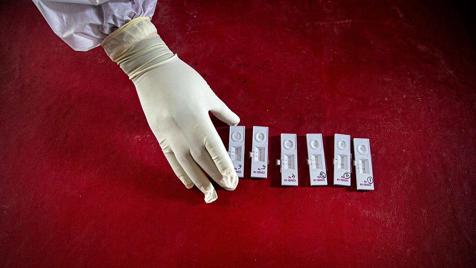 Covid-19 testi aktif olmayan virüsleri de sayıyor