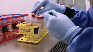 AstraZeneca reprend ses essais cliniques