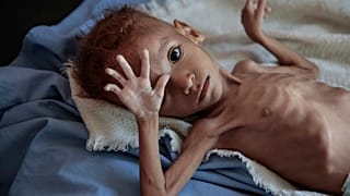 Selon l’ONU, 24 millions de Yéménites ont besoin d'aide humanitaire