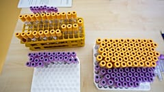 Koronavírusteszthez levett minták a Pécsi Tudományegyetem mintavételi pontján