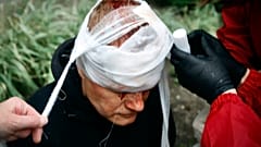 متظاهر بيلاروسي أصيب في رأسه 