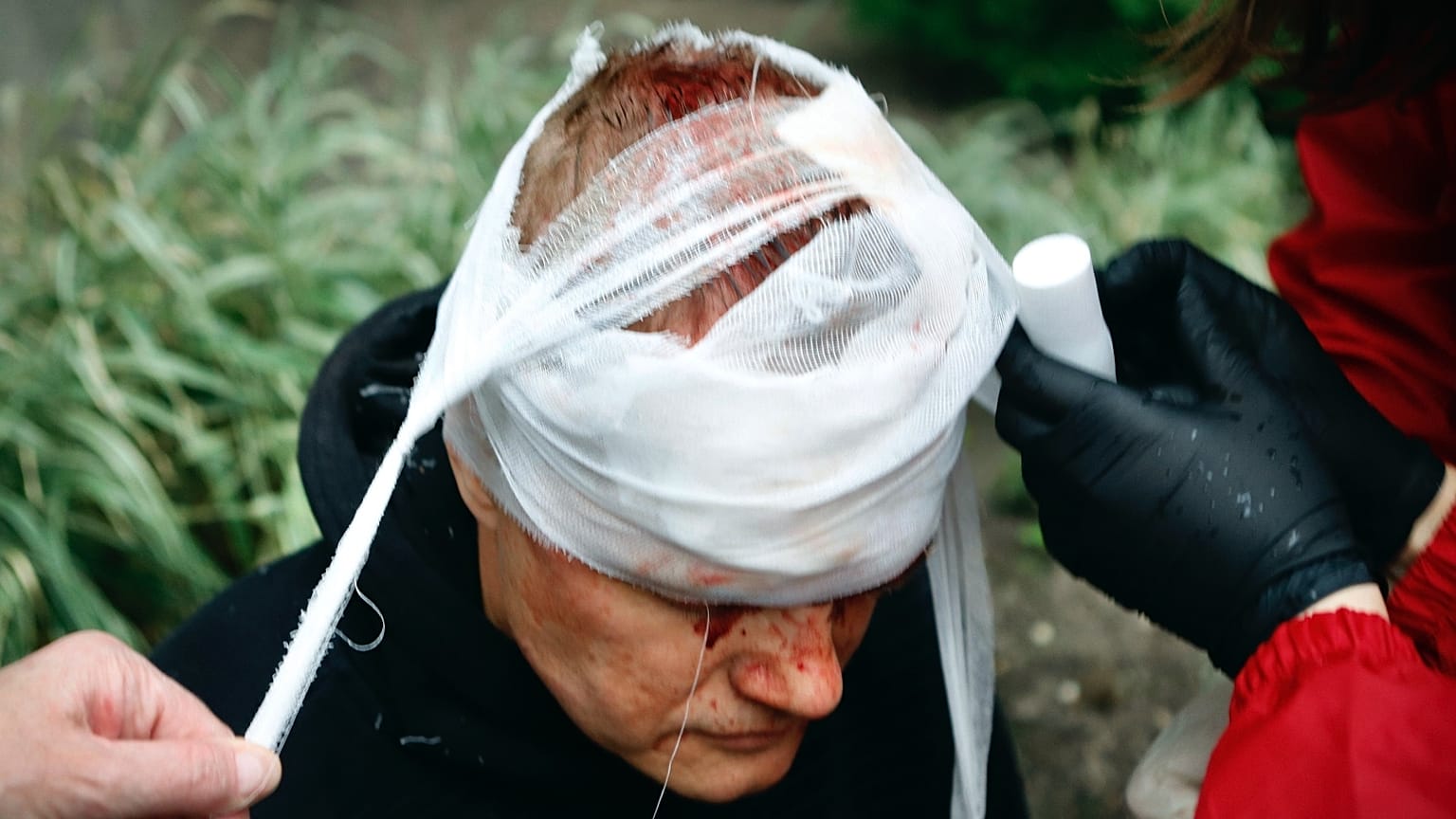 Sérült tüntetőt ápolnak Minszkben, október 11-én