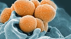 Esta imagen muestra una imagen de microscopio electrónico del estreptococo del grupo A (naranja) durante la interacción fagocítica con un neutrófilo humano (azul).