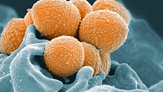 Esta imagen muestra una imagen de microscopio electrónico del estreptococo del grupo A (naranja) durante la interacción fagocítica con un neutrófilo humano (azul).