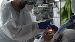 طبيب يعاين مريضاً مصاباً بفيروس كورونا في وحدة العناية المركزة في إحدى مشافي مدينة ستراسبورغ شمالي فرنسا