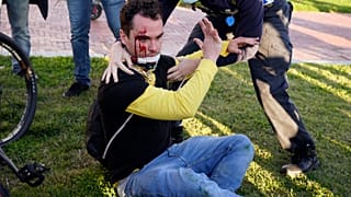 Un partidario del presidente Donald Trump herido después de ser atacado durante una manifestación pro-Trump, el 14 de noviembre de 2020, en Washington.