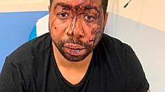 Brutaler Polizeieinsatz schockiert Frankreich