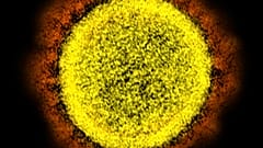 2020 electron microscope image made available by the National Institute of Allergy and Infectious Diseases shows a Novel Coronavirus SARS-CoV-2 particle isolated from a patien