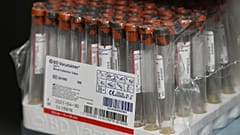 لقاح موديرنا المضاد لكوفيد-19