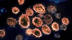 Virus Outbreak 