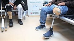 مبتورو الأطراف جراء الحرب في ليبيا بين مطرقة العلاج وسندان الانتظار الطويل