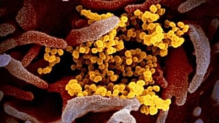 Una delle nuove varianti del coronavirus