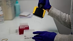 أخصائية تجهز عينات مجهرية في معهد المستشفى الجامعي لمقاومة الأمراض المعدية في مرسيليا جنوب فرنسا. 2021/01/13