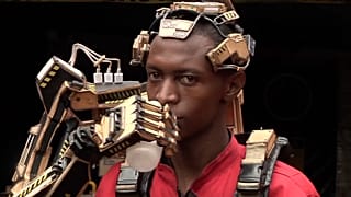 Kenya Prosthetic Arms